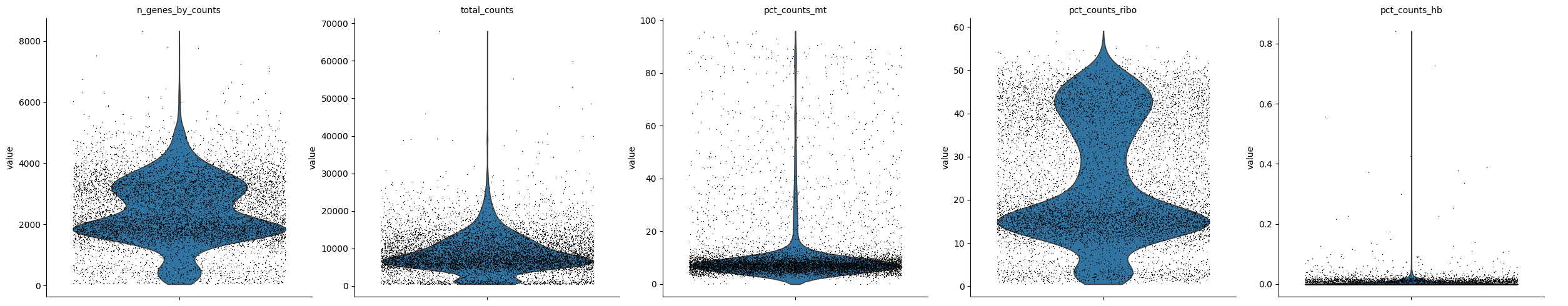 ../../../_images/tutorials_notebooks_scEve_scEve_clusterization_8_0.png